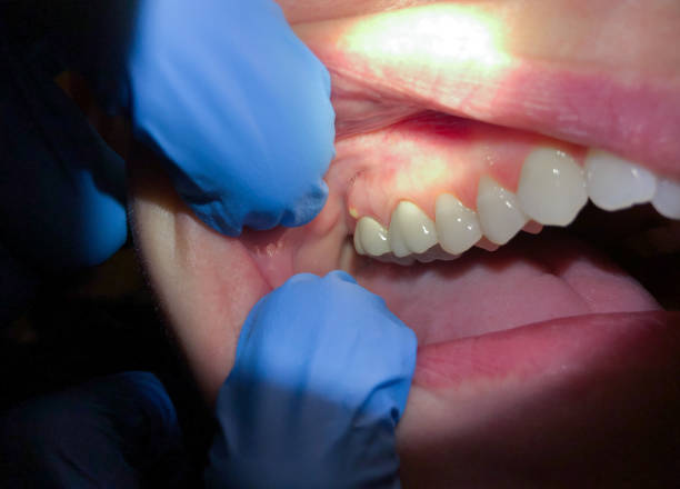 Best Pediatric Emergency Dentist in Cut Off, LA